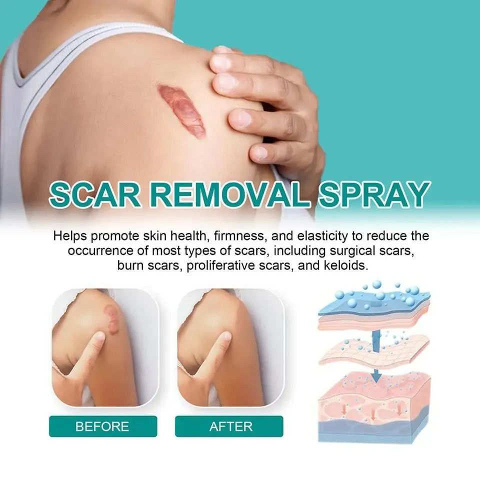 Scar Removal Spray Fade Scar -20g